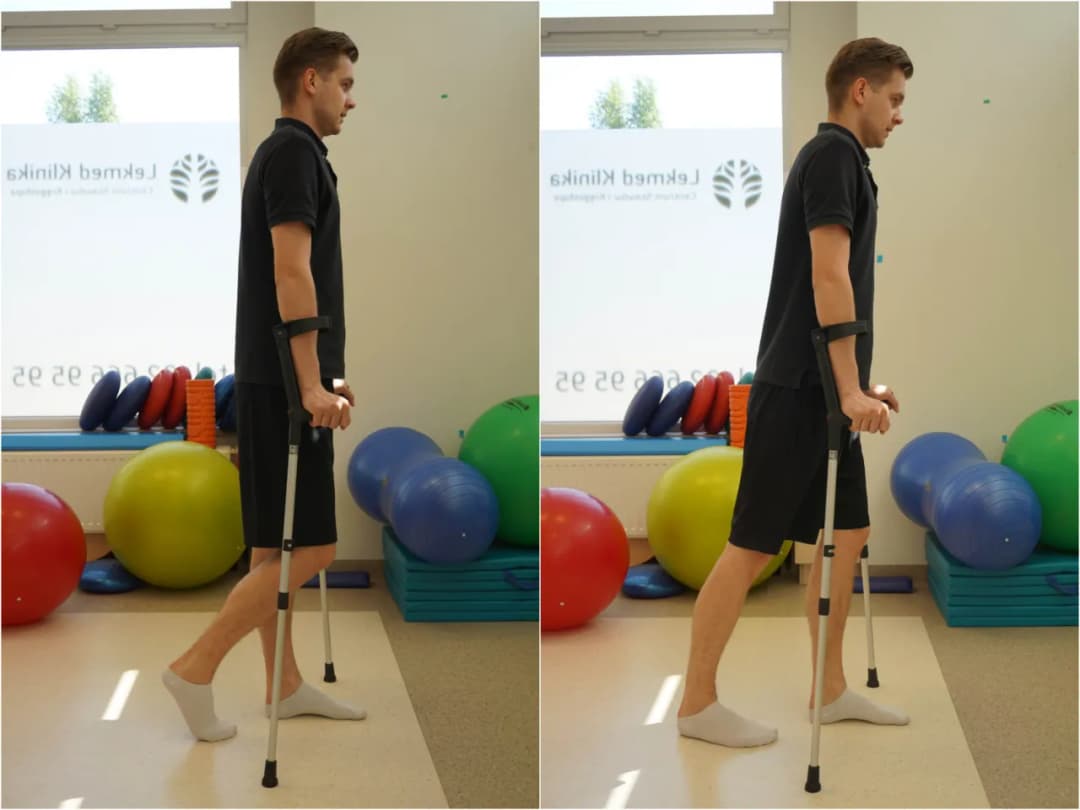 Jakie ćwiczenia po złamaniu kłykcia pomogą w szybszej rehabilitacji?